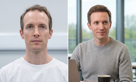 Frontal density hair restoration
