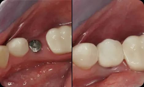 Rafael from Bucharest before and after result